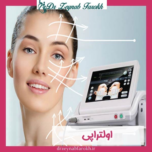 اولتراپی