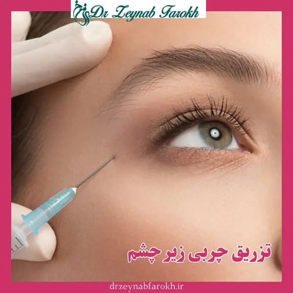 تزریق چربی زیر چشم _ دکتر زینب فرخ