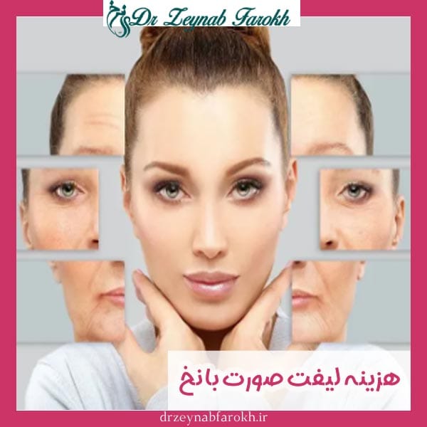 هزینه لیفت صورت با نخ