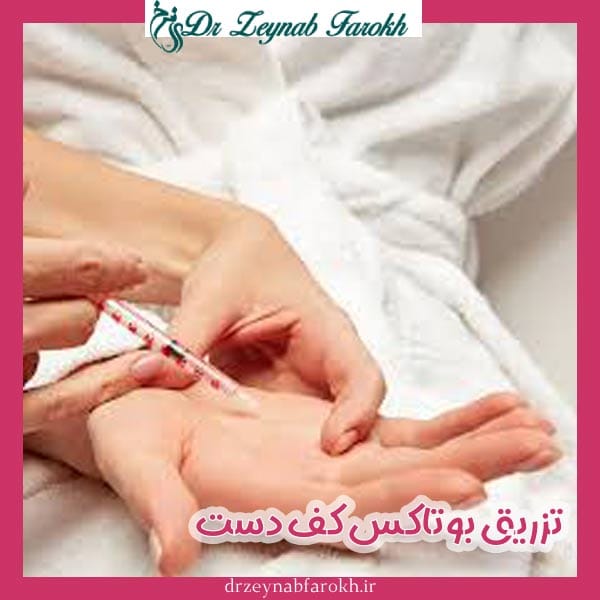تزریق بوتاکس کف دست _ دکتر زینب فرخ