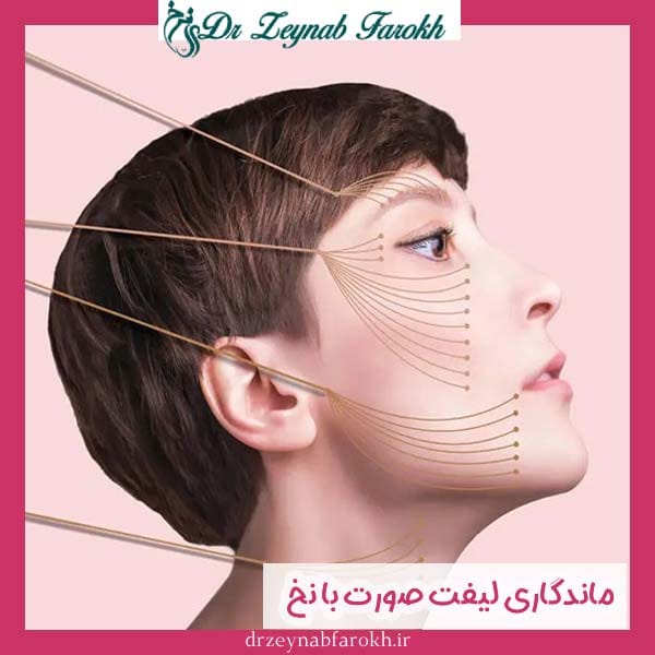 ماندگاری لیفت صورت با نخ
