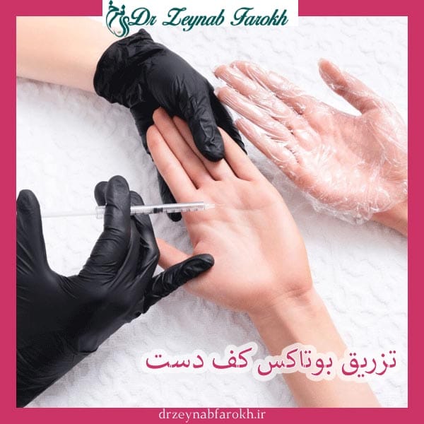 تزریق بوتاکس کف دست _ دکتر زینب فرخ