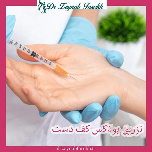 تزریق بوتاکس کف دست _ دکتر زینب فرخ