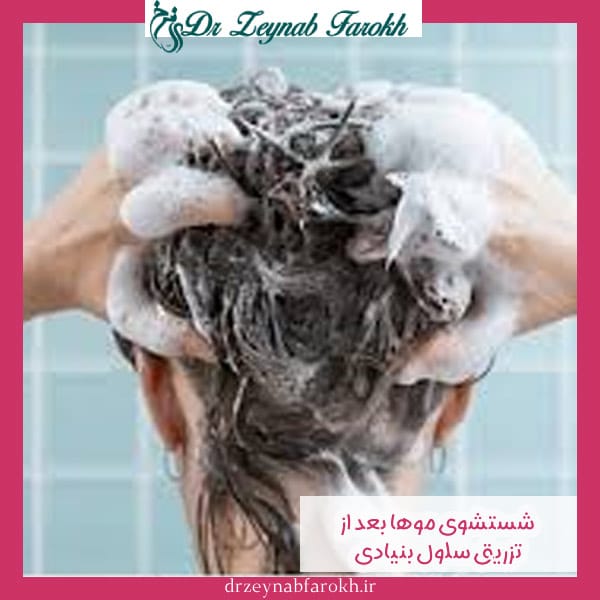 شستشوی مو بعد از تزریق سلول بنیادی - دکتر زینب فرخ -drzeynabfarokh.ir