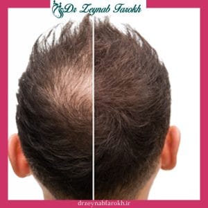 عکس نتیجه جی سل -دکتر زینب فرخ - drzeynabfarokh.ir