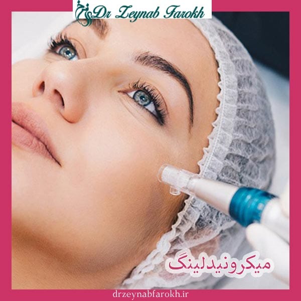 مزایای میکرونیدلینگ _ دکتر زینب فرخ