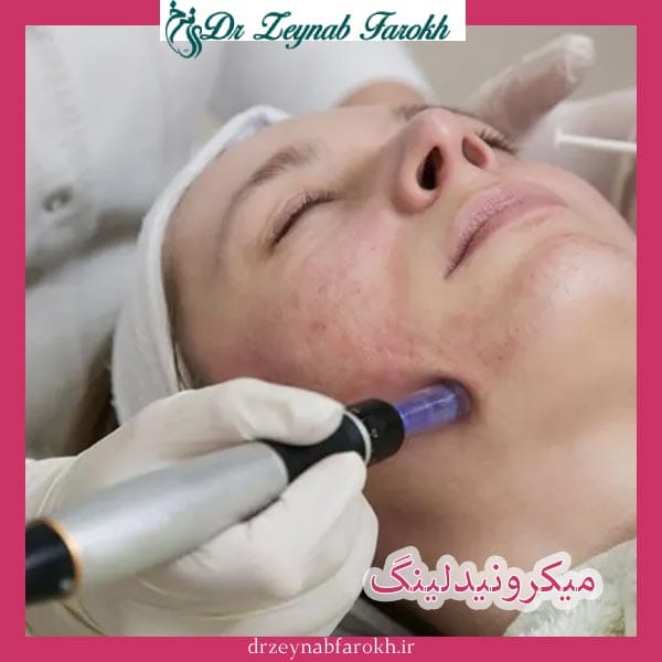 مزایای میکرونیدلینگ _ دکتر زینب فرخ