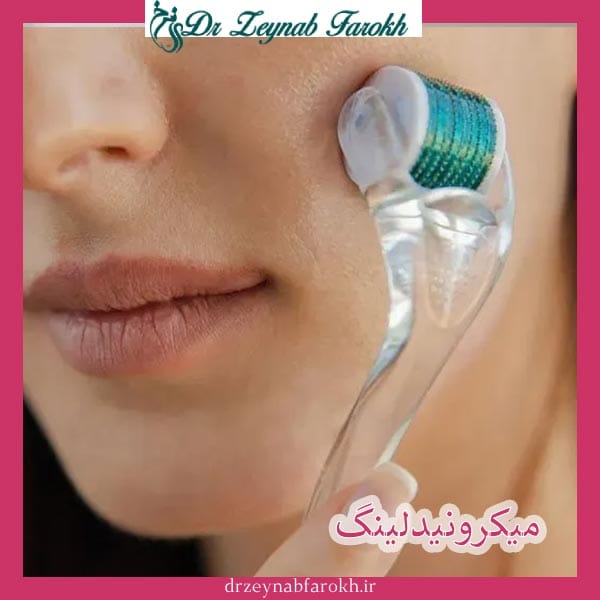مزایای میکرونیدلینگ _ دکتر زینب فرخ