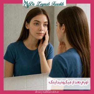 ورم بعد از میکرونیدلینگ - دکتر فرخ - drzeynabfarokh.ir