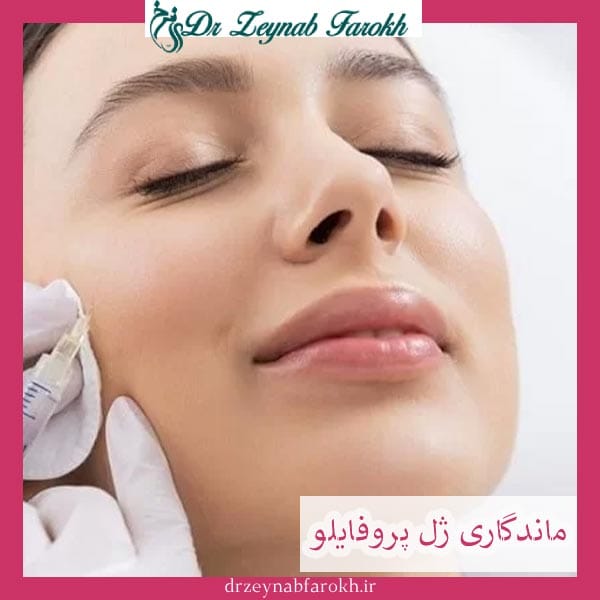 ماندگاری ژل پروفایلو _ دکتر زینب فرخ