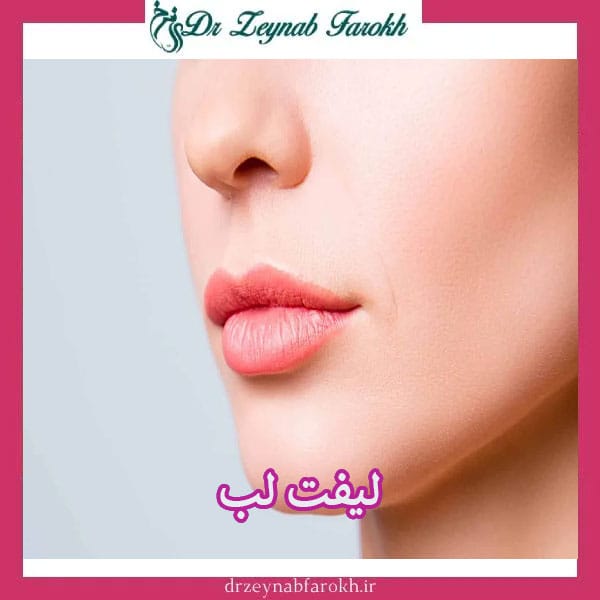 لیفت لب _ دکتر زینب فرخ