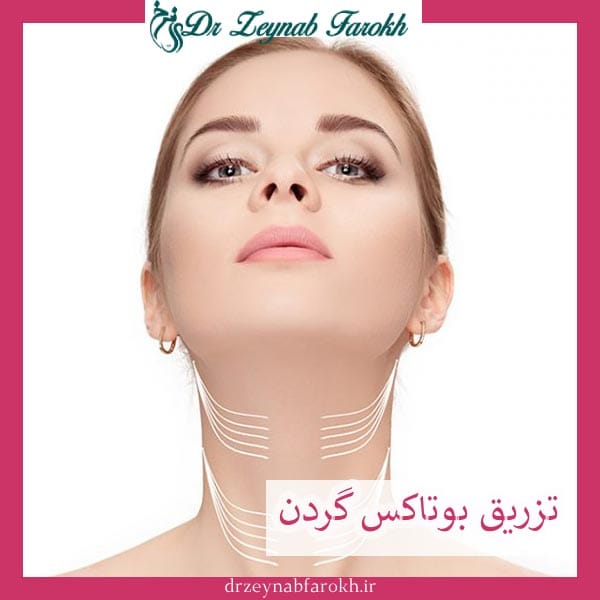 تزریق بوتاکس گردن _ دکتر زینب فرخ
