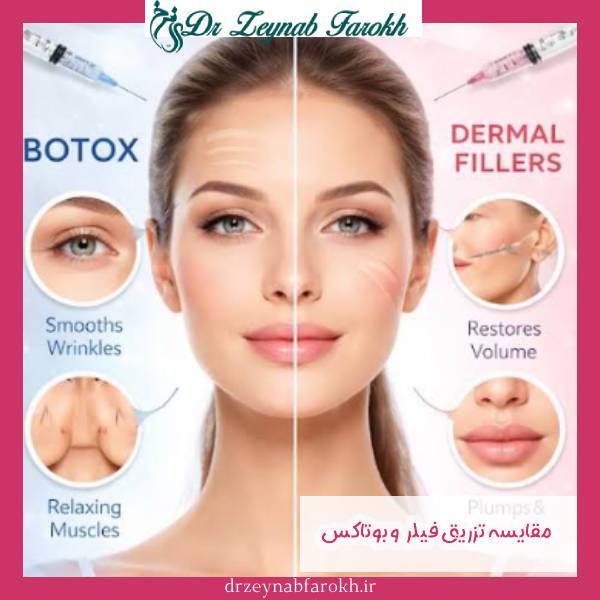 تزریق فیلر و بوتاکس