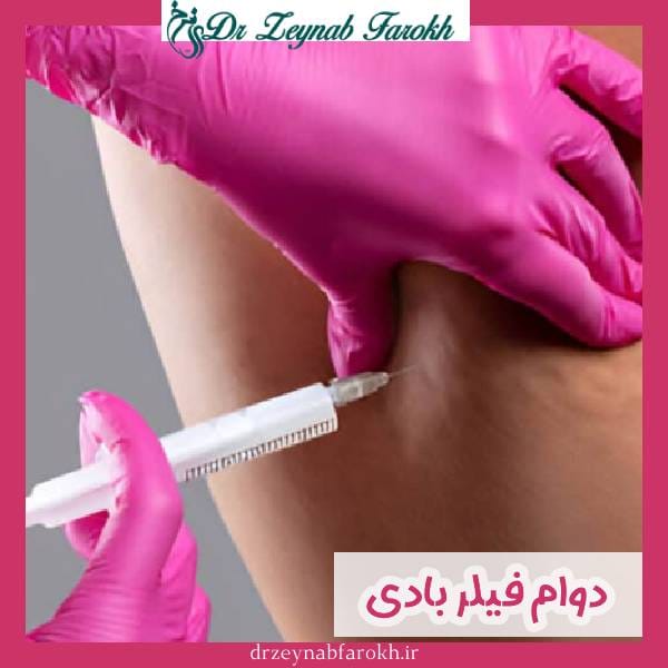 دوام و ماندگاری فیلر بادی