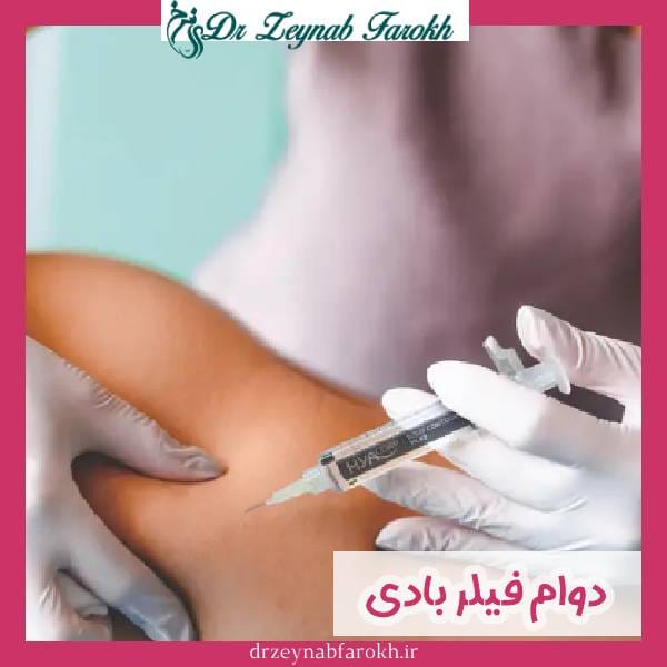 دوام و ماندگاری فیلر بادی